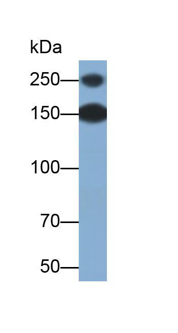 Polyclonal Antibody to Complement Factor H (CFH)