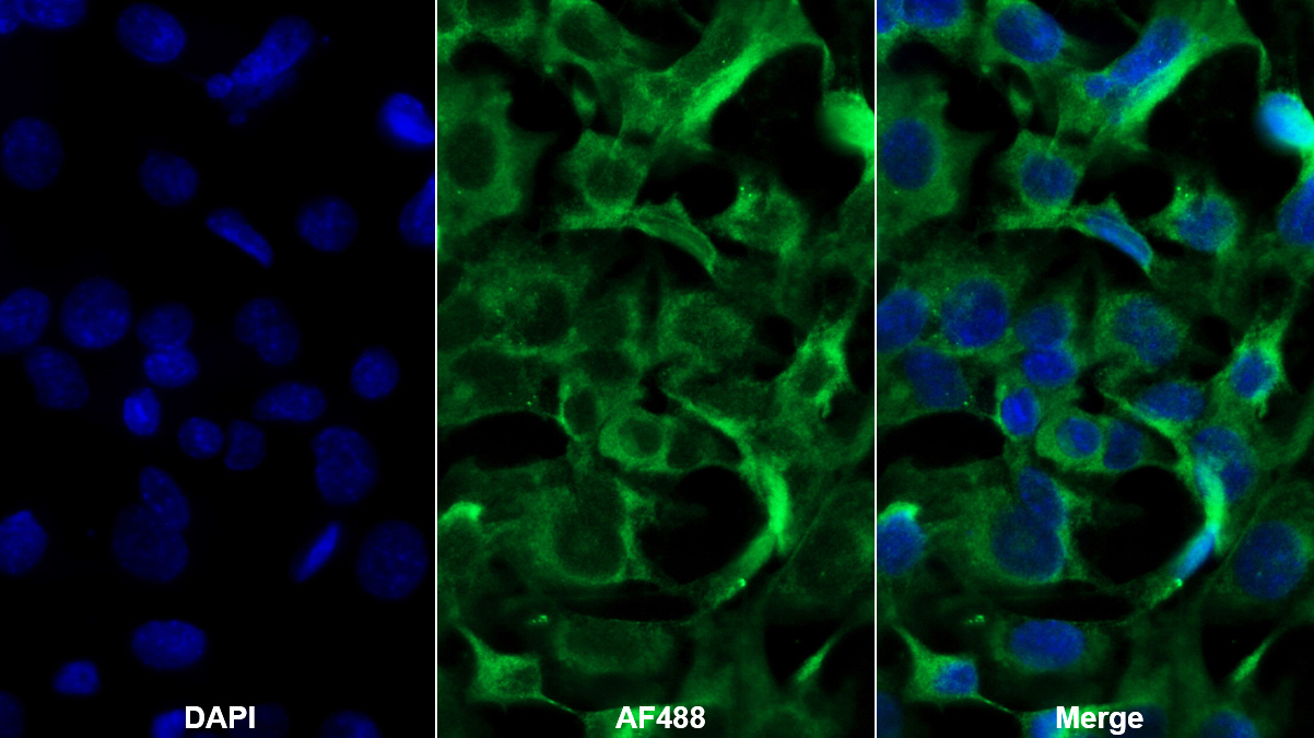 Polyclonal Antibody to Hexosaminidase B Beta (HEXb)