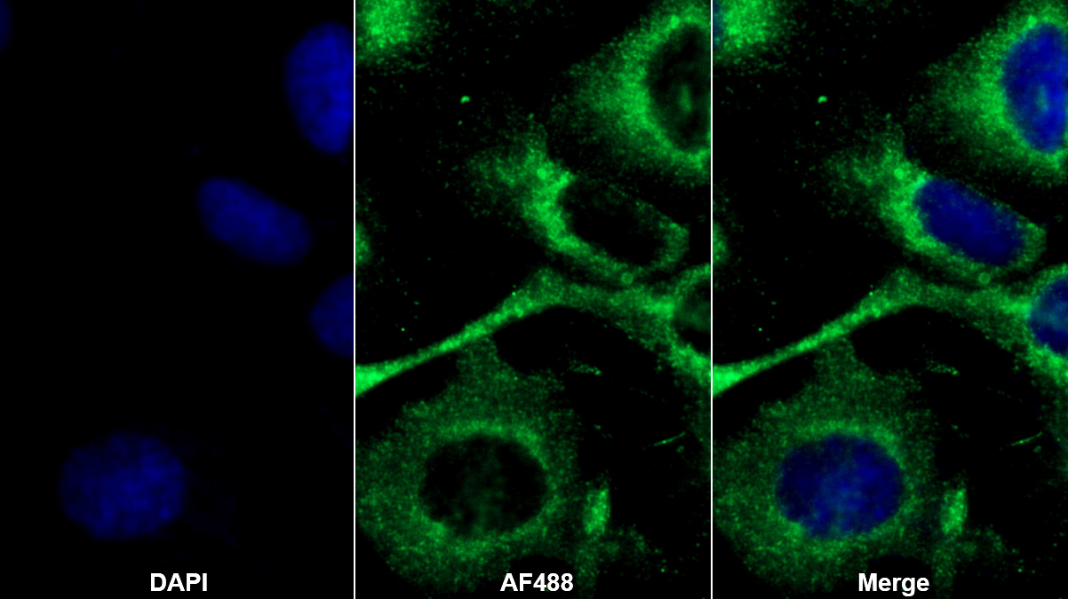 Polyclonal Antibody to Cross Linked N-Telopeptide Of Type I Collagen (NTXI)