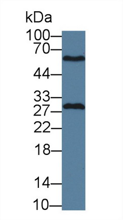 Polyclonal Antibody to Glutathione S Transferase Mu 4 (GSTm4)