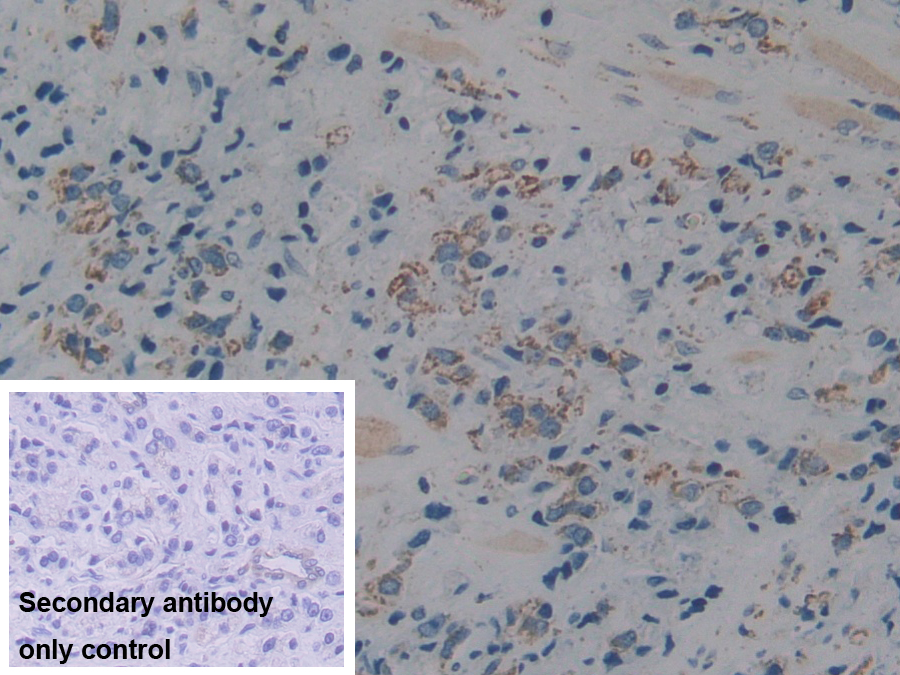 Polyclonal Antibody to Complement component 1 Q subcomponent-binding protein, mitochondrial (C1QBP)