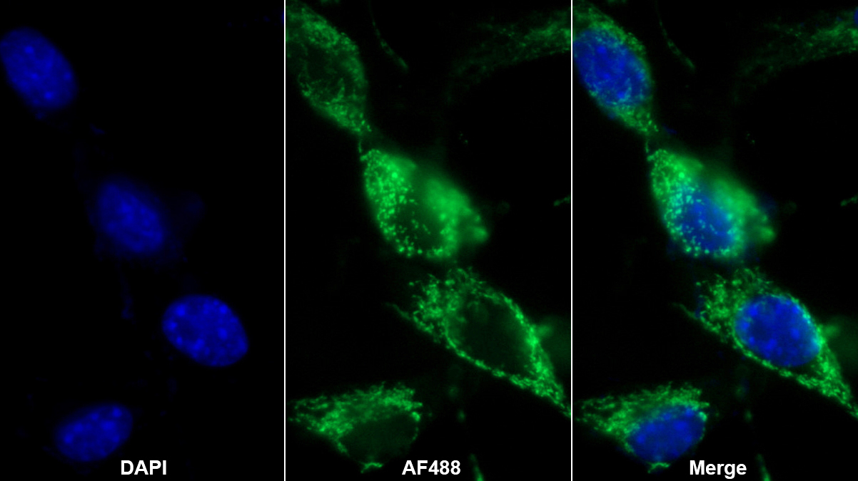 Polyclonal Antibody to Complement component 1 Q subcomponent-binding protein, mitochondrial (C1QBP)