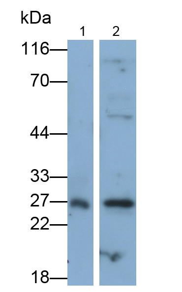 Polyclonal Antibody to Glutathione S Transferase Mu 2 (GSTM2)