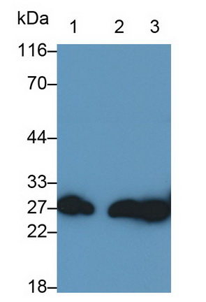 Polyclonal Antibody to Glutathione S Transferase Mu 2 (GSTM2)