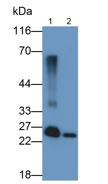 Polyclonal Antibody to Glutathione S Transferase Mu 1 (GSTM1)