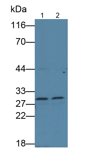 Polyclonal Antibody to Glutathione S Transferase Mu 1 (GSTM1)