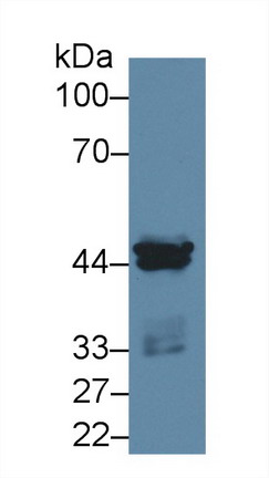 Polyclonal Antibody to Casein Kinase 1 Alpha 1 (CSNK1a1)