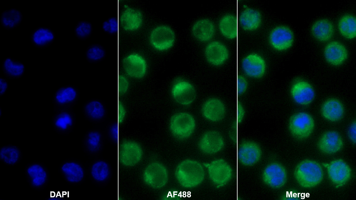 Polyclonal Antibody to Toll Like Receptor 2 (TLR2)
