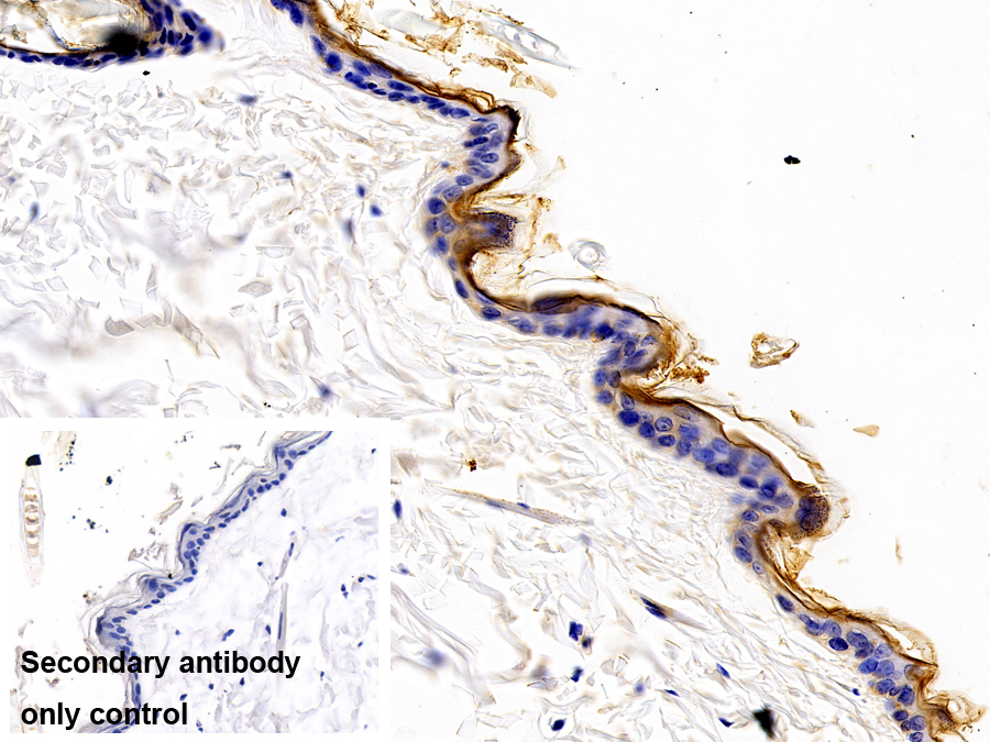 Polyclonal Antibody to Kallikrein 11 (KLK11)