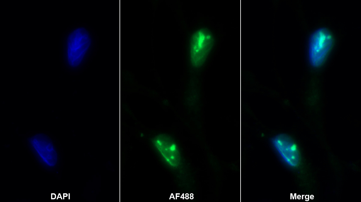 Polyclonal Antibody to CCAAT/Enhancer Binding Protein Gamma (CEBPg)