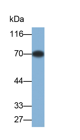 Polyclonal Antibody to Coagulation Factor XII (F12)