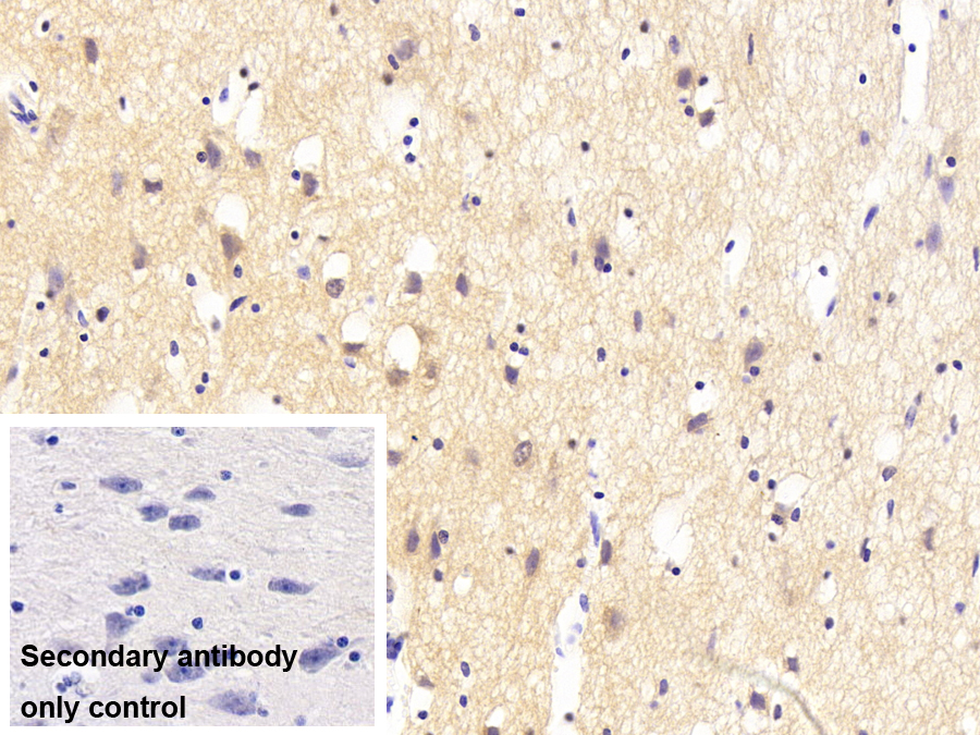 Polyclonal Antibody to Membrane Protein, Palmitoylated 2 (MPP2)