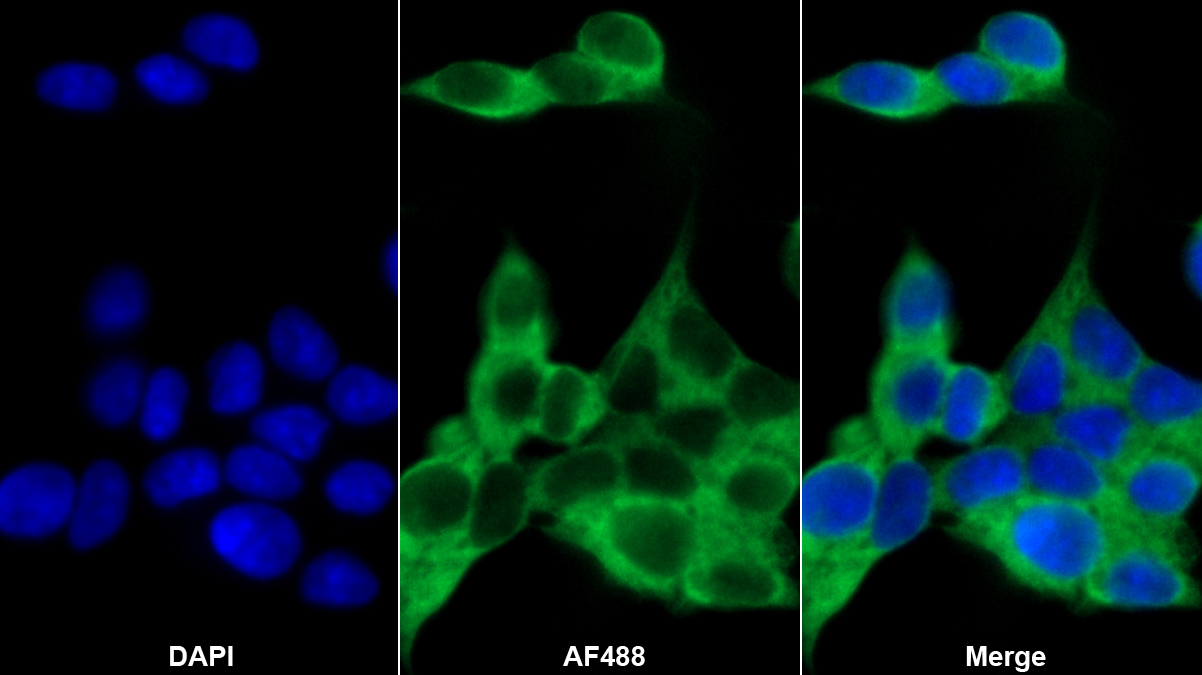 Polyclonal Antibody to Kallikrein 8 (KLK8)