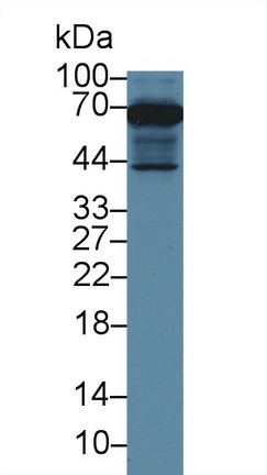 Polyclonal Antibody to Membrane Protein, Palmitoylated 6 (MPP6)