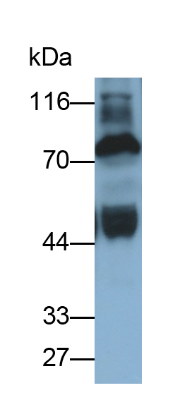 Polyclonal Antibody to Prothrombin Fragment 1+2 (F1+2)