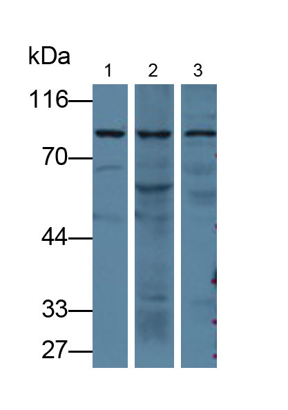 Polyclonal Antibody to Prothrombin Fragment 1+2 (F1+2)