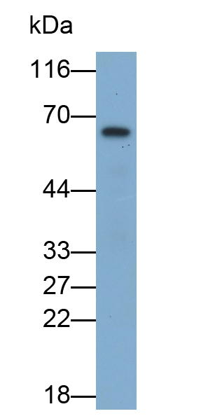 Polyclonal Antibody to Glucose-6-phosphate Dehydrogenase (G6PD)