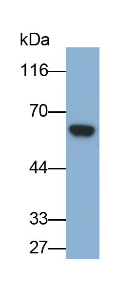 Polyclonal Antibody to Glucose-6-phosphate Dehydrogenase (G6PD)