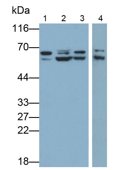 Polyclonal Antibody to Glucose 6 Phosphate Isomerase (GPI)