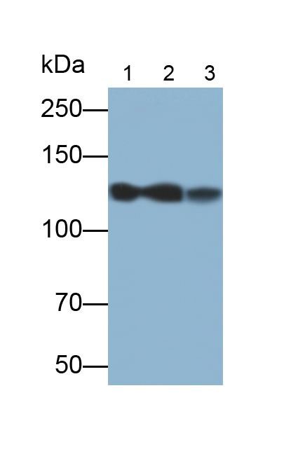 Polyclonal Antibody to Desmoglein 1 (DSG1)