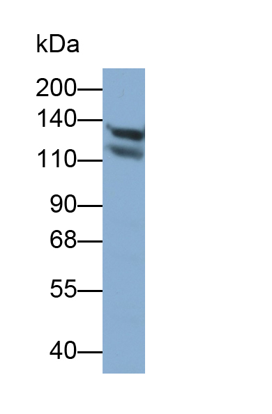 Polyclonal Antibody to Desmoglein 1 (DSG1)