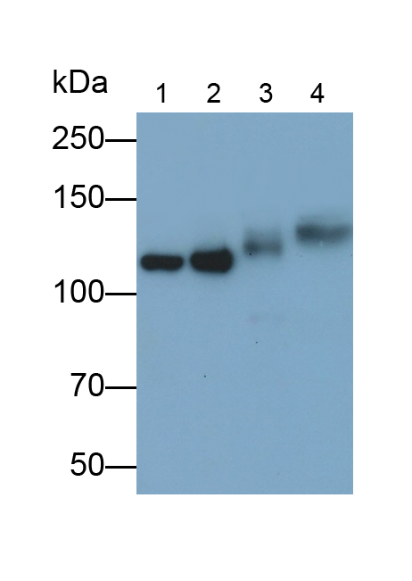 Polyclonal Antibody to Epidermal Growth Factor Receptor (EGFR)