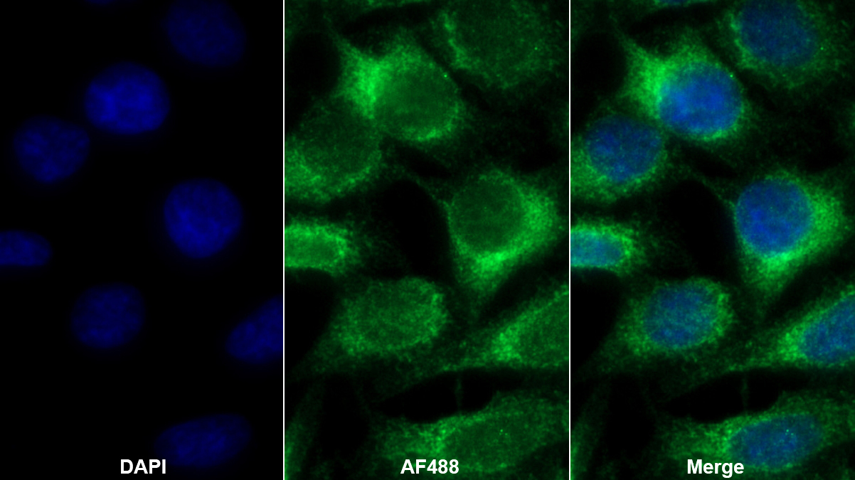 Polyclonal Antibody to Epidermal Growth Factor Receptor (EGFR)