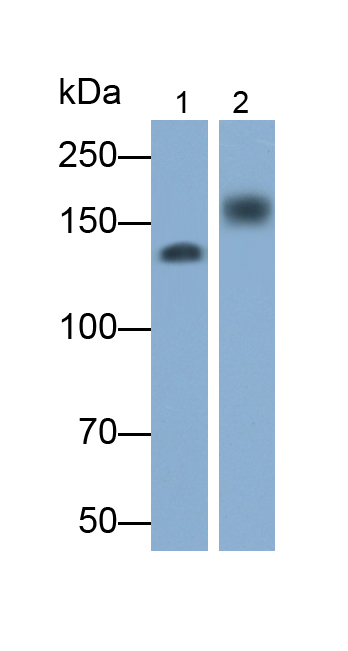 Polyclonal Antibody to Epidermal Growth Factor Receptor (EGFR)