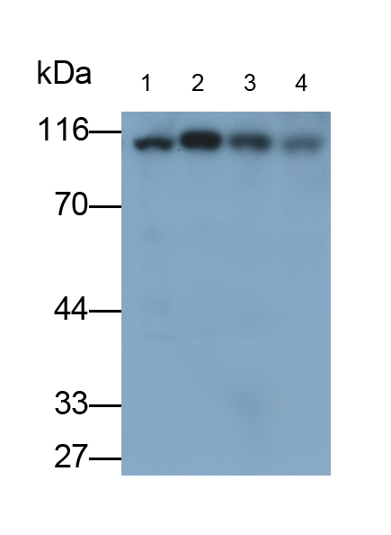 Polyclonal Antibody to Hexokinase 1 (HK1)