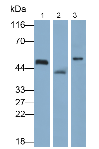 Polyclonal Antibody to Pyruvate dehydrogenase alpha 1 (PDHA1)