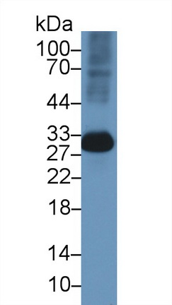 Polyclonal Antibody to Carbonic Anhydrase II (CA2)