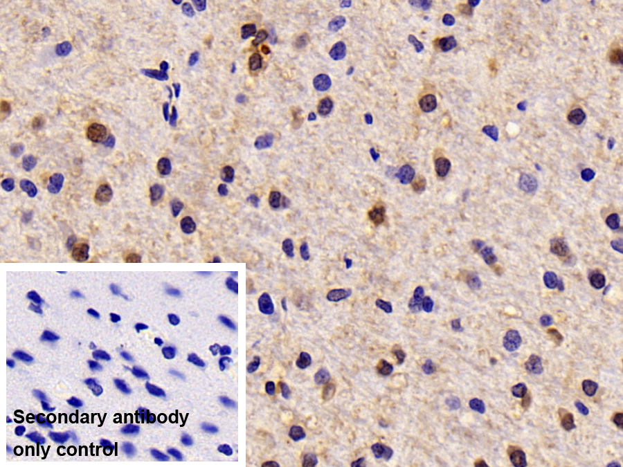 Polyclonal Antibody to Carbonic Anhydrase II (CA2)