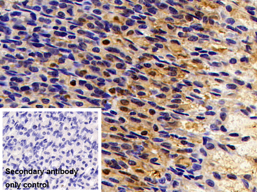 Polyclonal Antibody to Carbonic Anhydrase II (CA2)