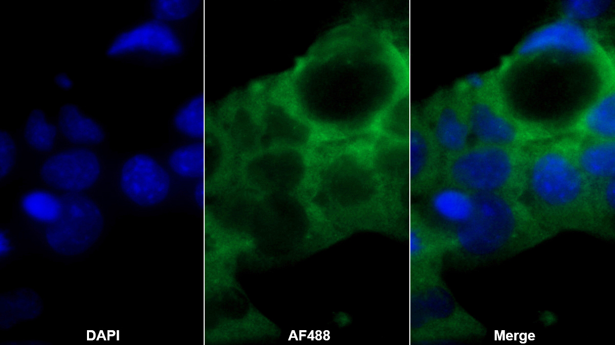 Polyclonal Antibody to Carbonic Anhydrase II (CA2)