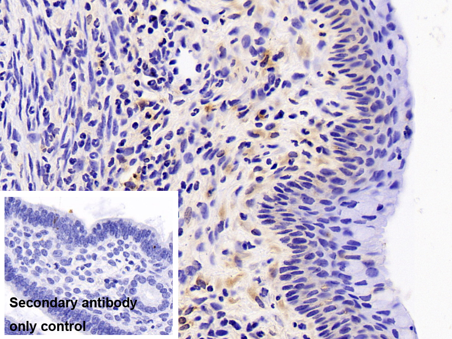 Polyclonal Antibody to Ficolin 1 (FCN1)