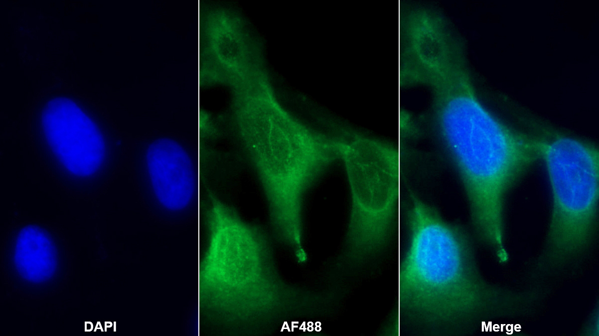 Polyclonal Antibody to Osteonectin (ON)