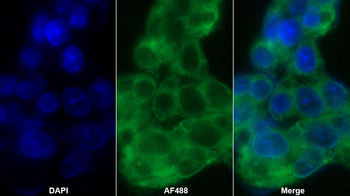 Polyclonal Antibody to Angiotensinogen (AGT)