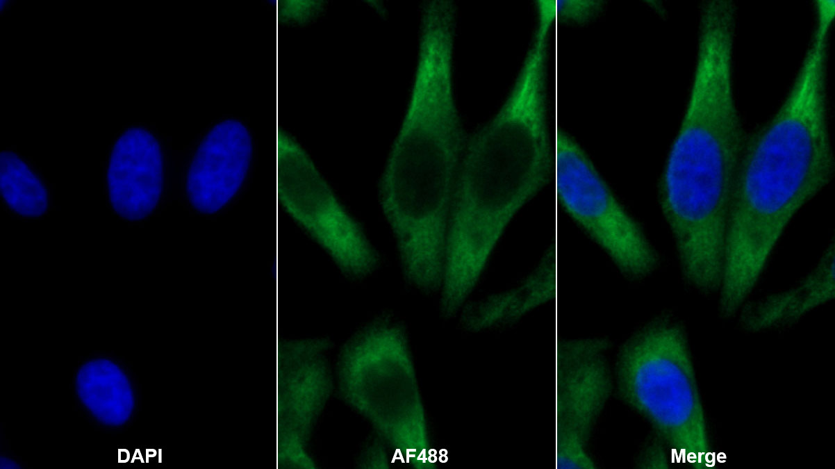 Polyclonal Antibody to Angiotensinogen (AGT)