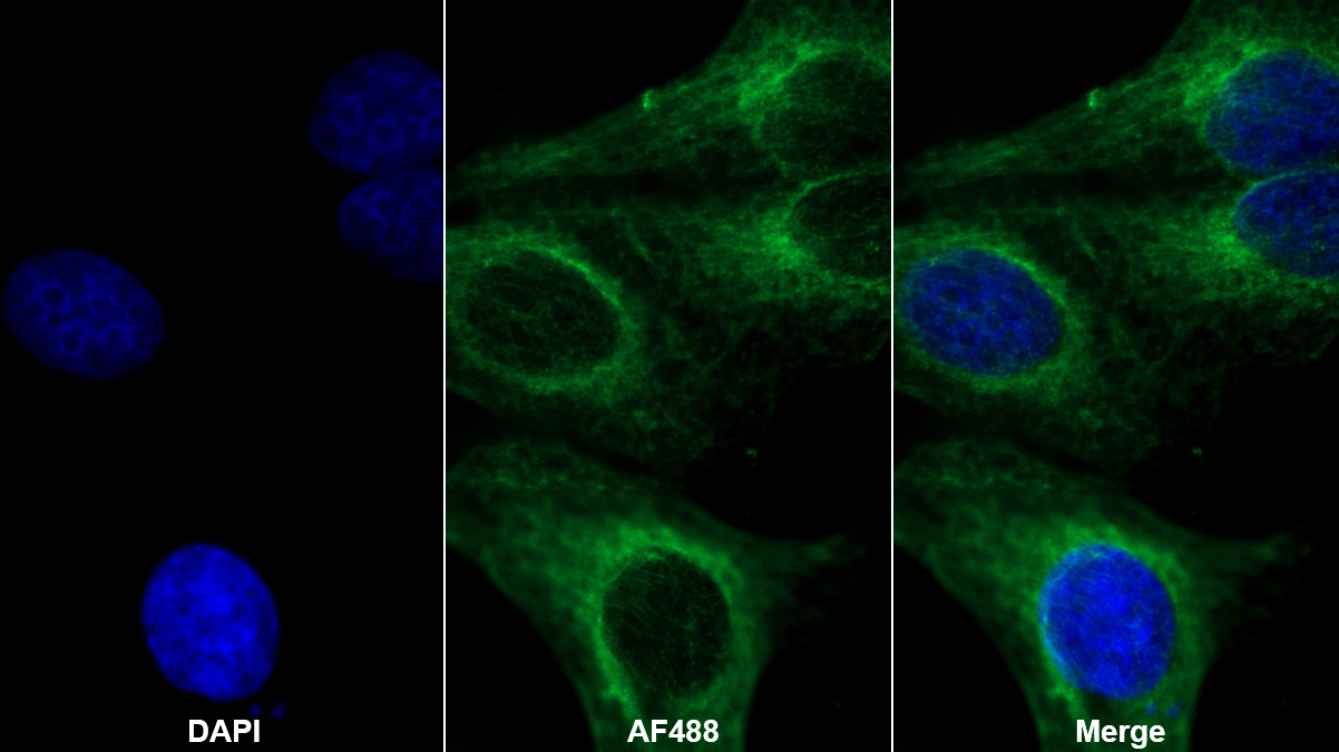 Polyclonal Antibody to Cholesteryl Ester Transfer Protein (CETP)