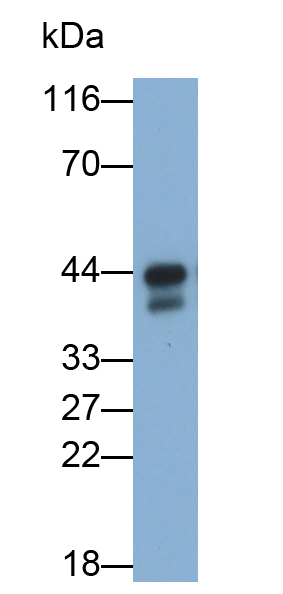 Polyclonal Antibody to Alpha-1-Acid Glycoprotein (a1AGP)