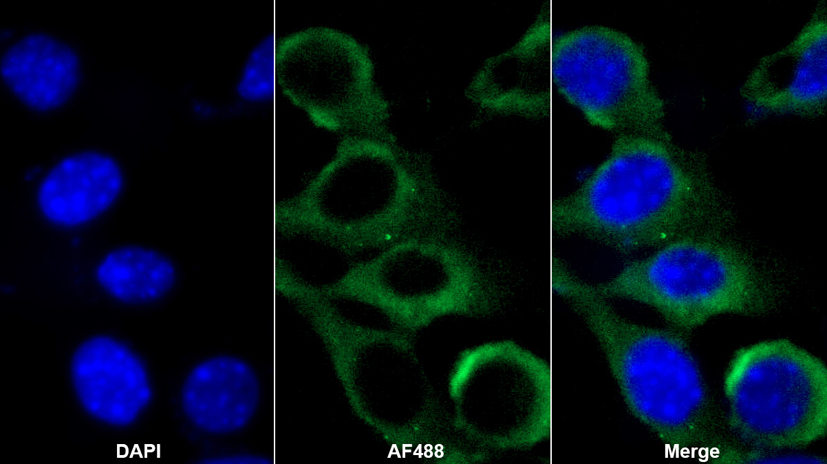 Polyclonal Antibody to Alpha-1-Acid Glycoprotein (a1AGP)