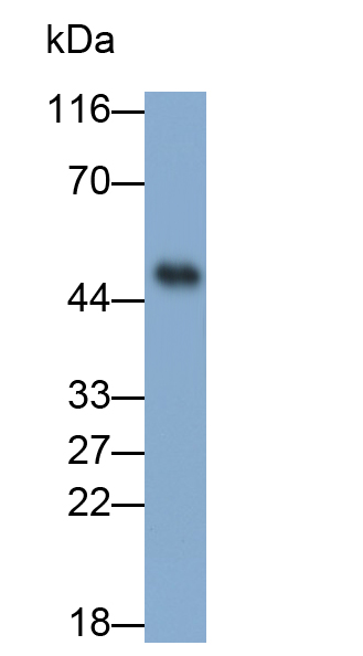 Polyclonal Antibody to Alpha-1-Acid Glycoprotein (a1AGP)