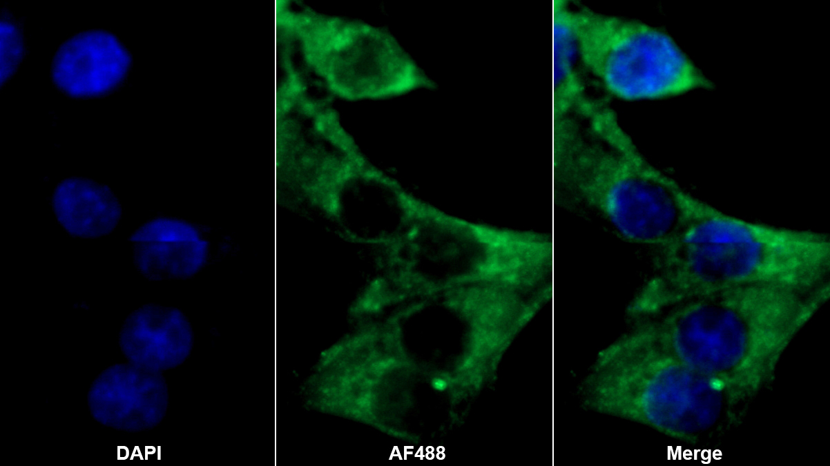 Polyclonal Antibody to Haptoglobin (Hpt)