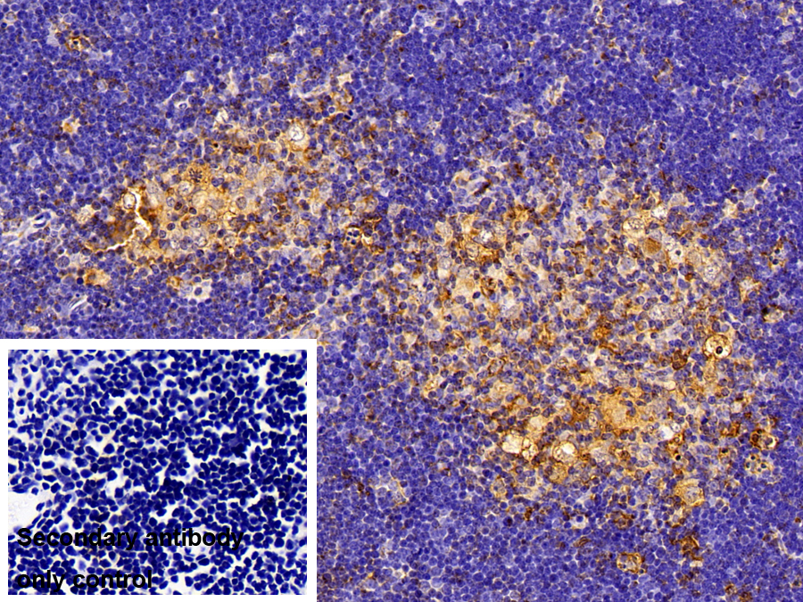 Polyclonal Antibody to Death receptor 5 (DR5)