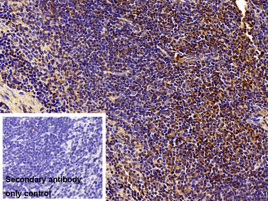 Polyclonal Antibody to Death receptor 5 (DR5)