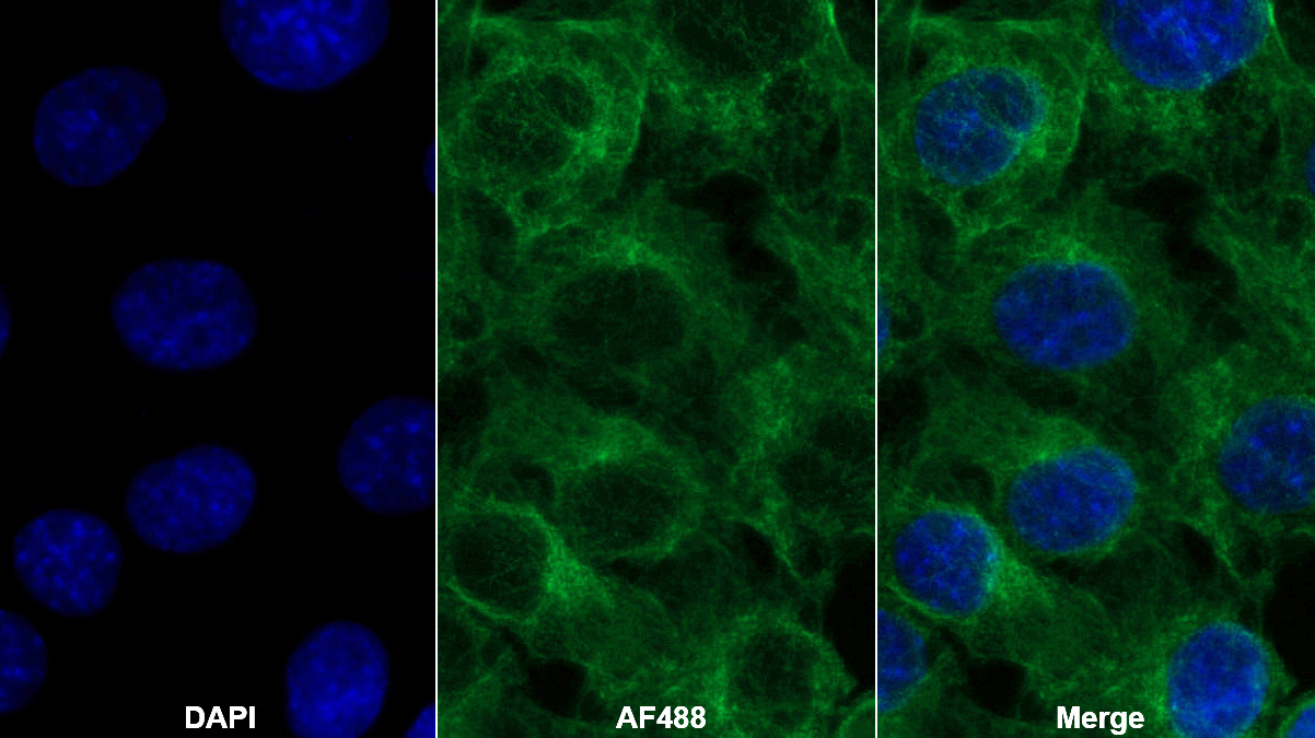 Polyclonal Antibody to Coagulation Factor II (F2)