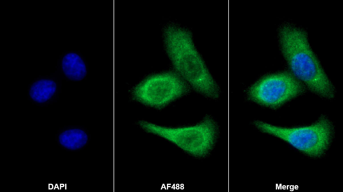 Polyclonal Antibody to C Reactive Protein (CRP)