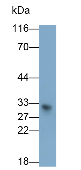 Polyclonal Antibody to C Reactive Protein (CRP)