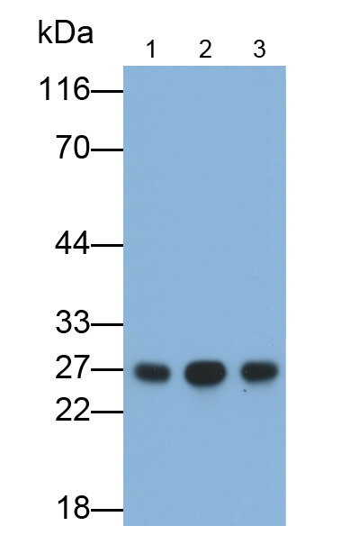 Polyclonal Antibody to C Reactive Protein (CRP)