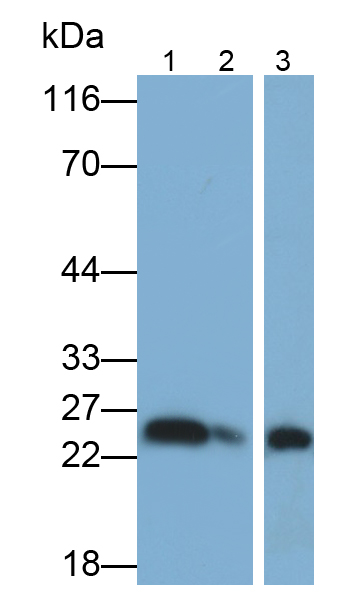 Polyclonal Antibody to C Reactive Protein (CRP)